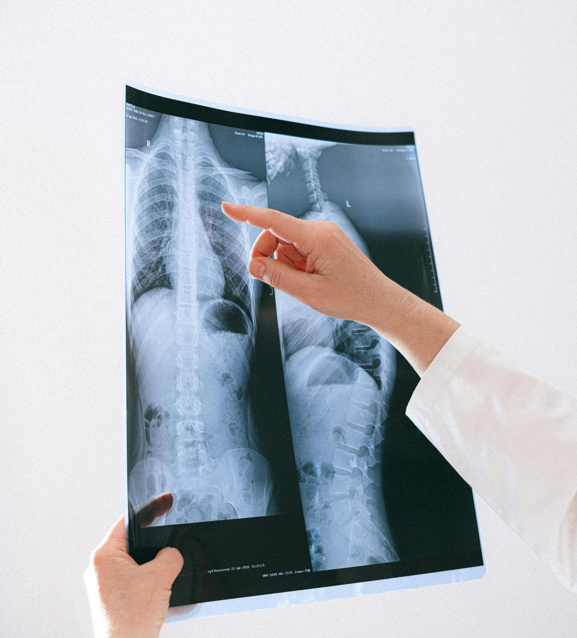 Фтизиатрия (ересектер, балалар)