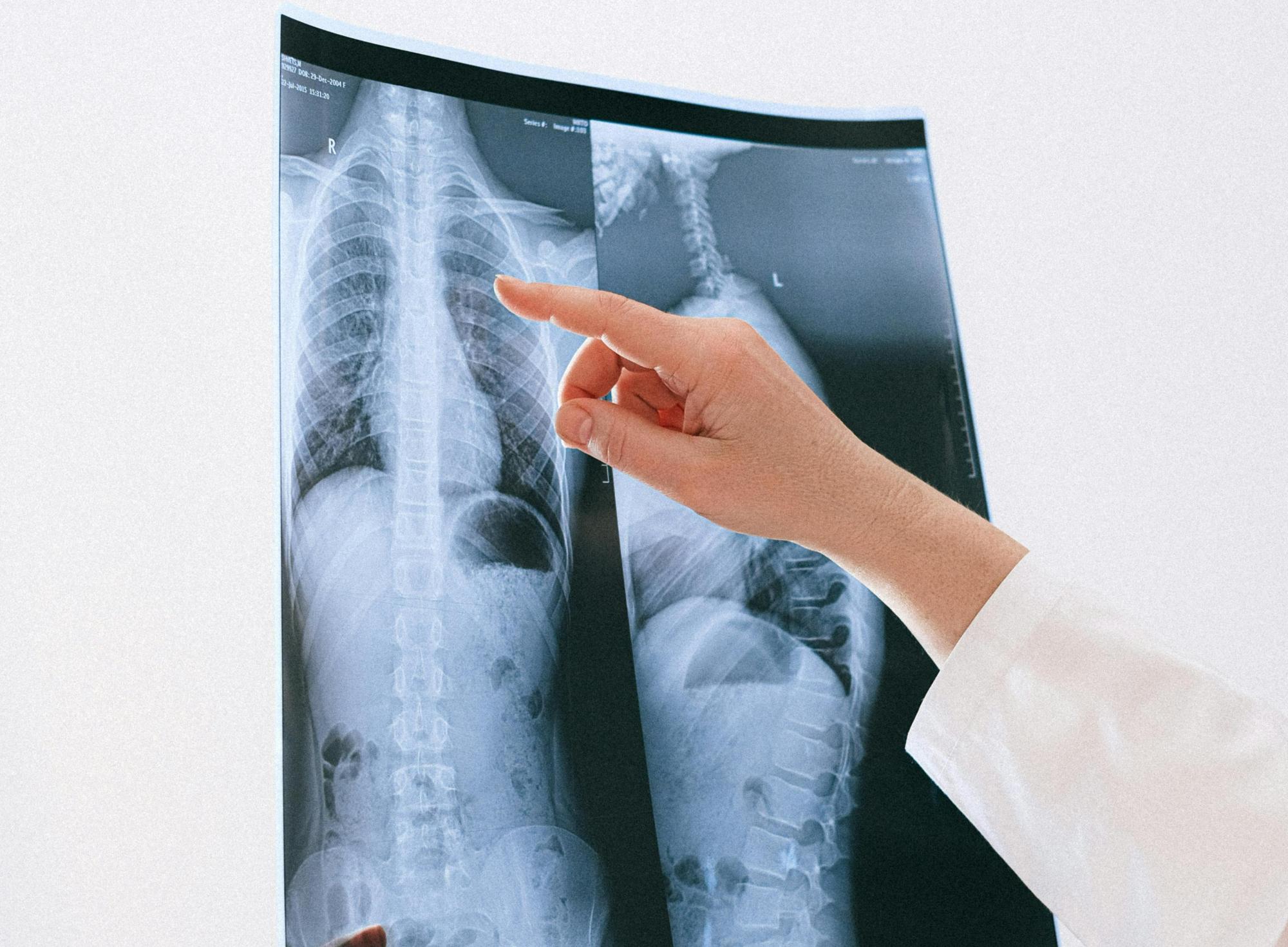 Фтизиатрия (взрослая, детская)